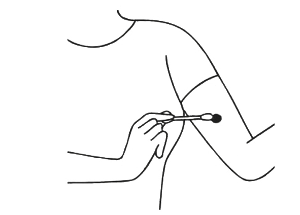 パッチテストのイラスト